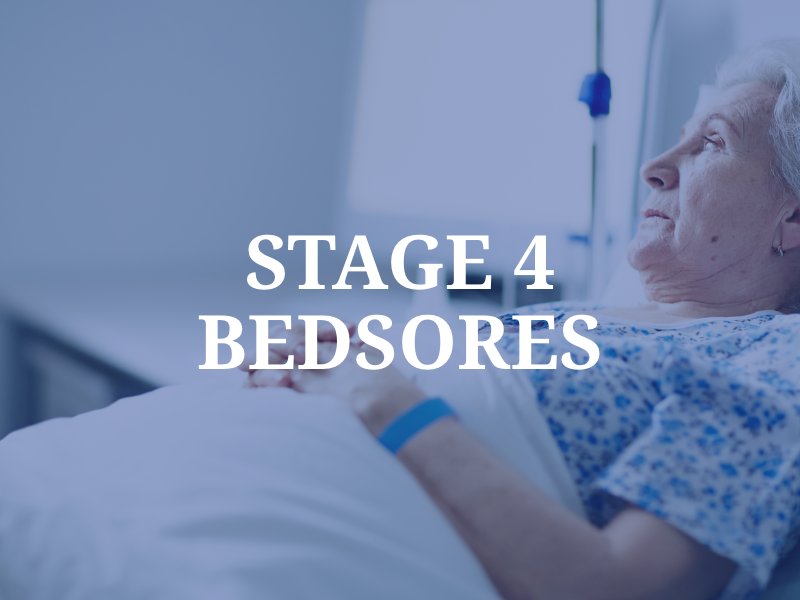 Stage 4 Bedsores